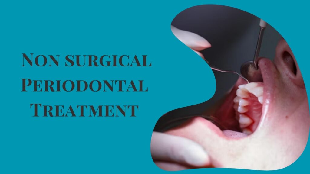 What is non surgical Periodontal Treatment