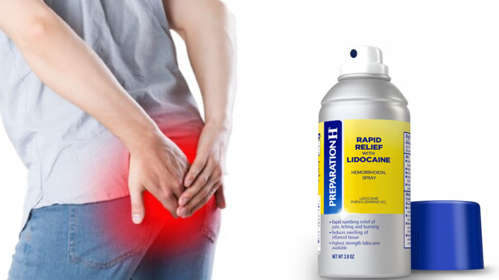 Numbing Spray for Hemorrhoids